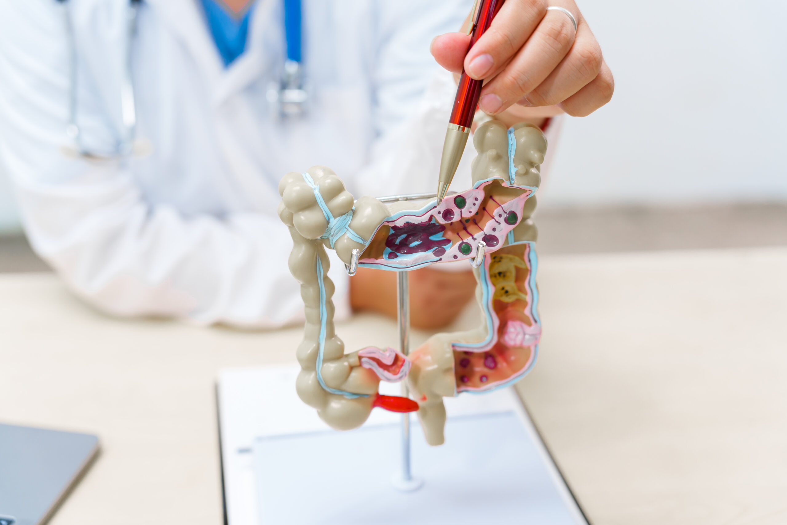 Darmgesundheit Lampertheim – Ursachen für Verdauungsprobleme erkennen und ganzheitlich behandeln