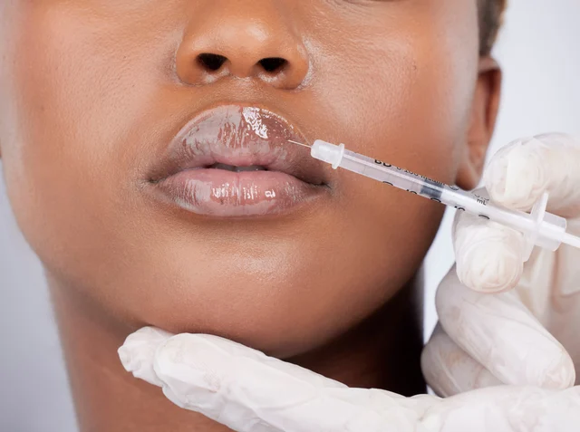 Lippenunterspritzung für Patientinnen aus Mannheim – bewusst außerhalb der Innenstadt