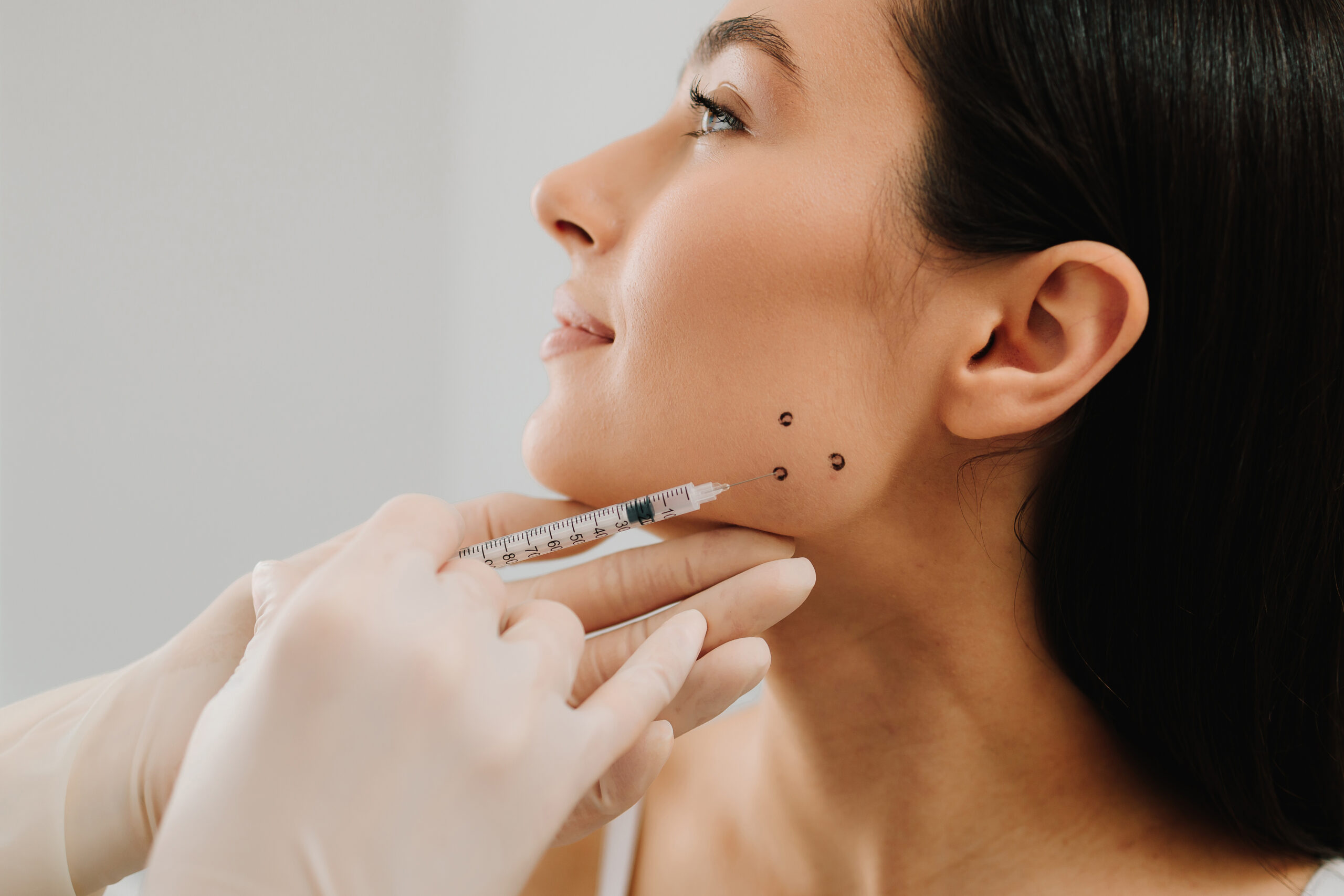 Jawline-Contouring mit Hyaluronsäure
