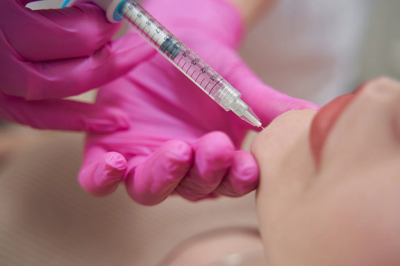 Bioremodellierung mit Profhilo®