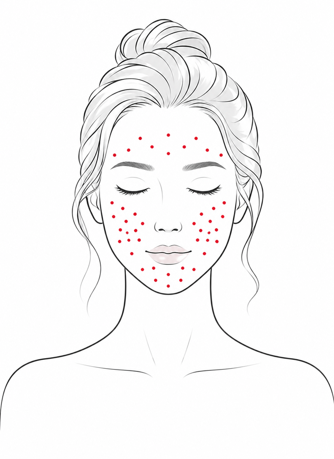 Polynukleotide Behandlung Full-Face mit PhilArt in Lampertheim