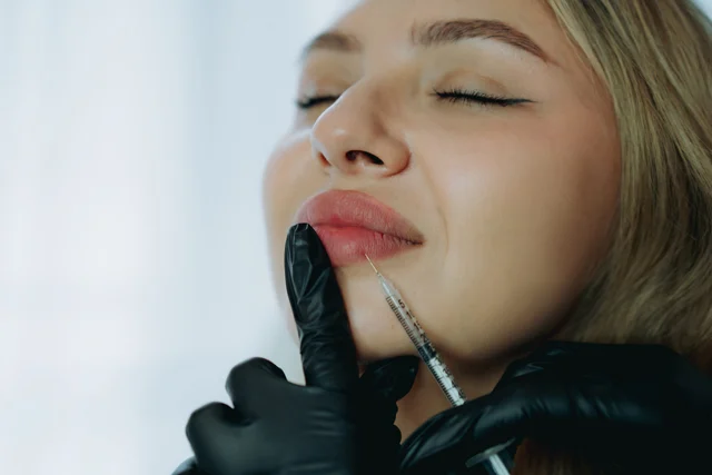 Lippenunterspritzung oder Lip Flip – was passt besser?