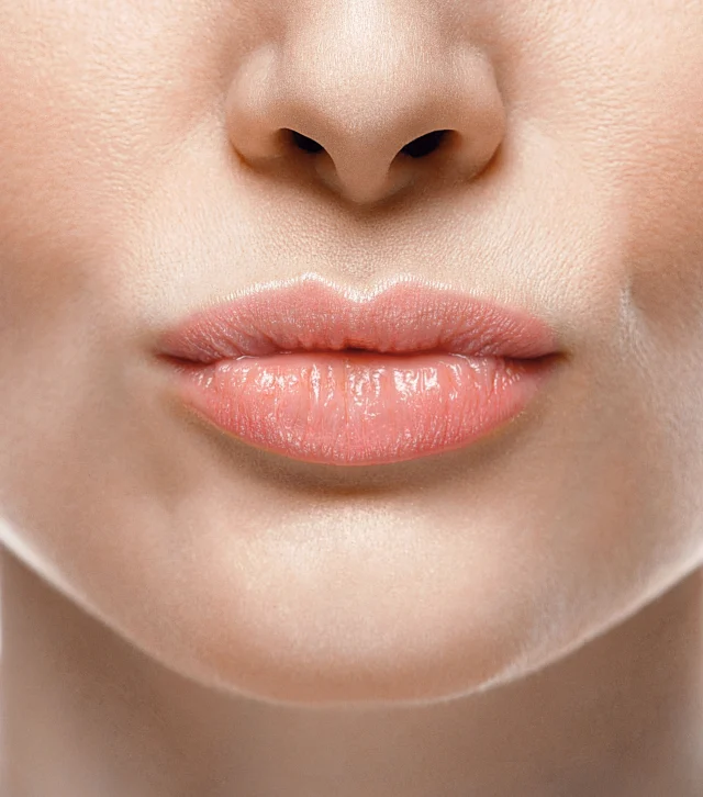 Natürliche Lippenunterspritzung ohne Duckface