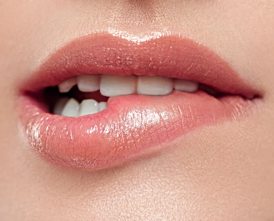 Lippenunterspritzung in Lampertheim – natürlich volle Lippen statt künstlicher Effekte