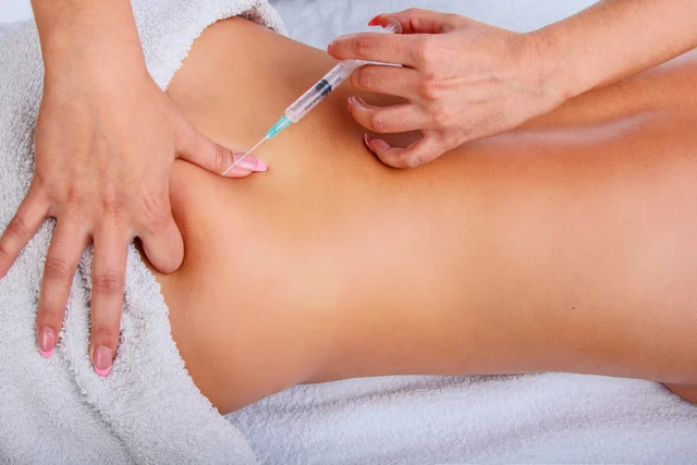 Cellulite-Behandlung Gernsheim – Mesotherapie Alidya™