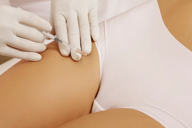 Cellulite-Spritze Lorsch – Orangenhaut gezielt behandeln