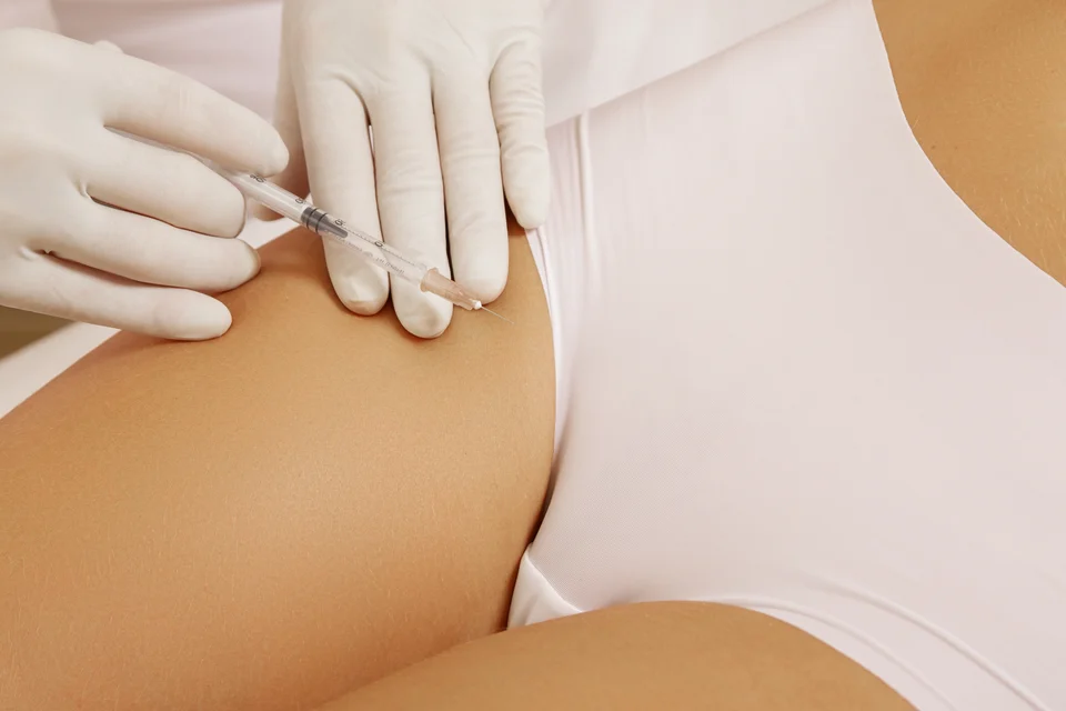 Cellulite-Spritze Lorsch – Orangenhaut gezielt behandeln