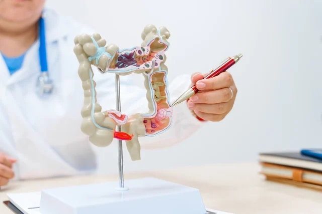Cellulite-Behandlung Bürstadt – Alidya™ Mesotherapie