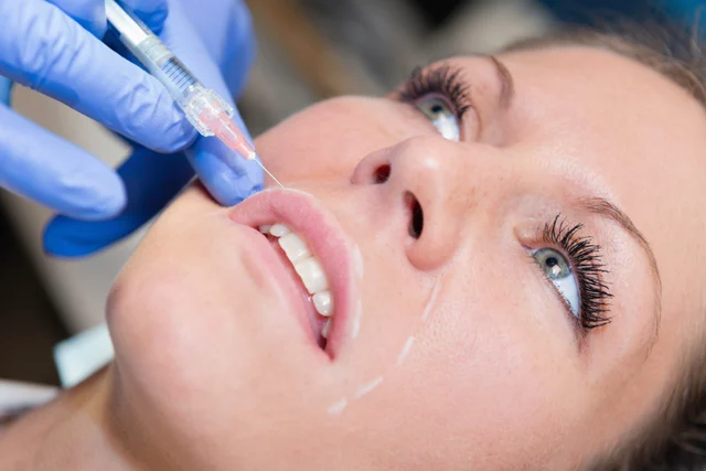 Ästhetische Behandlung – Welche Falten lassen sich mit Hyaluron behandeln?