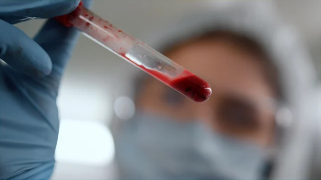 Laborprobe – Symbolbild für Hilfe bei Leaky Gut und Diagnostik