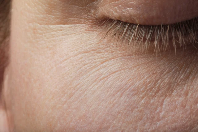 Ästhetische Behandlung – Was sind Polynukleotide eigentlich – und was hat Lachs-DNA damit zu tun?