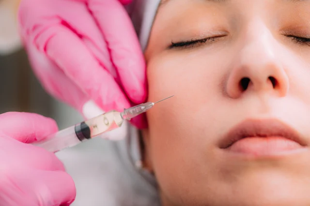 Ästhetische Behandlung – Faltenunterspritzung Gernsheim – natürlich frischer aussehen mit Hyaluron
