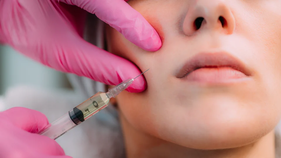 Ästhetische Behandlung – Faltenunterspritzung für Patientinnen aus Heppenheim – natürlich frischer aussehen