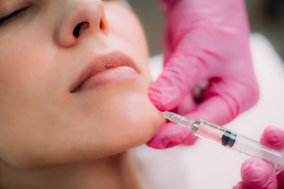 Ästhetische Behandlung – Faltenunterspritzung Viernheim – natürlich frischer aussehen mit Hyaluron