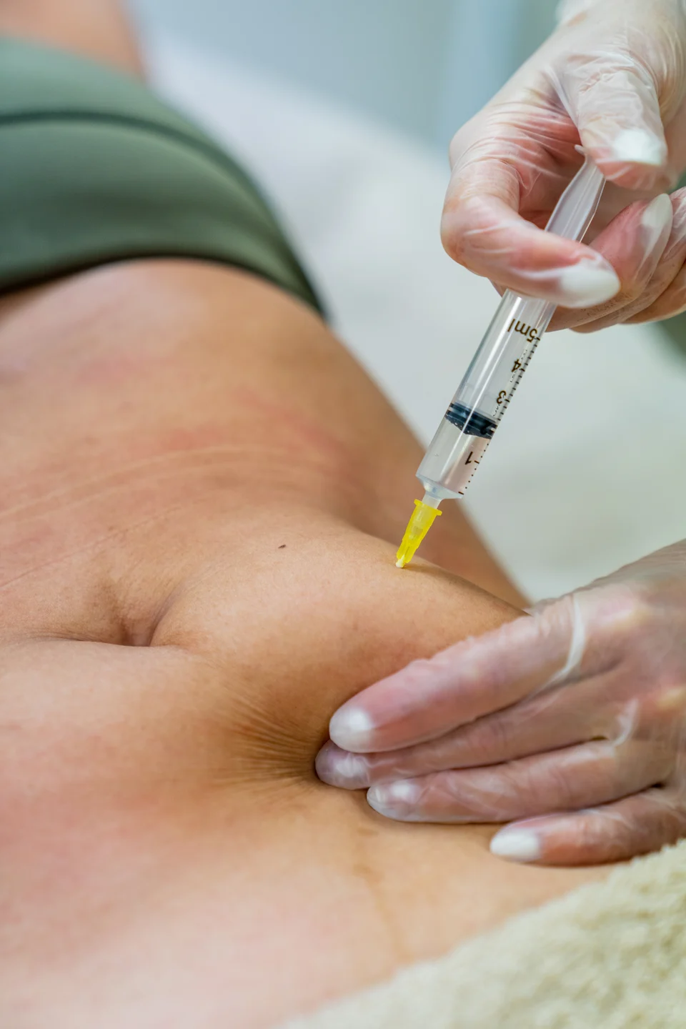 Infusionstherapie Heilpraktiker Lampertheim – Moderne Infusionskonzepte für mehr Energie und Wohlbefinden
