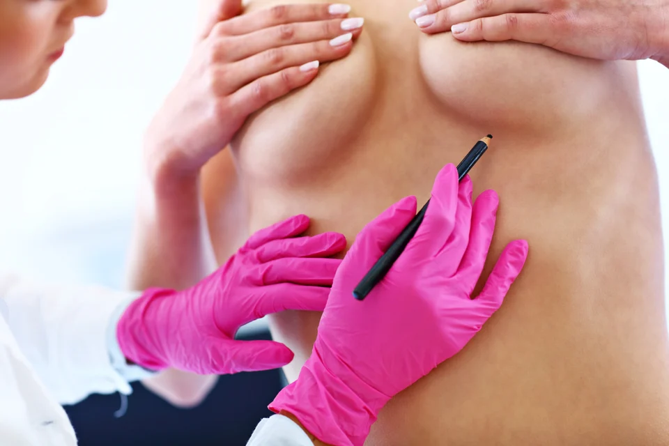 Ärztliche Brustuntersuchung – Aufklärung zur Brustvergrößerung mit Hyaluron