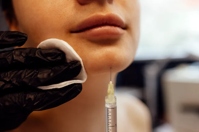 Ästhetische Behandlung – Der Sculptra vs. AestheFill Vergleich