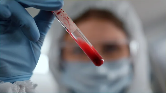 Labordiagnostik – Müde, schlapp, antriebslos? Warum ein Vitamin-D-Mangel oft dahintersteckt