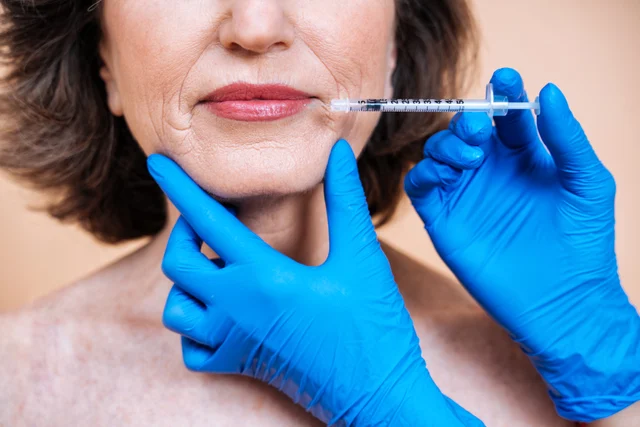 Ästhetische Behandlung – Faltenunterspritzung für Patientinnen aus Bürstadt – natürlich frischer aussehen