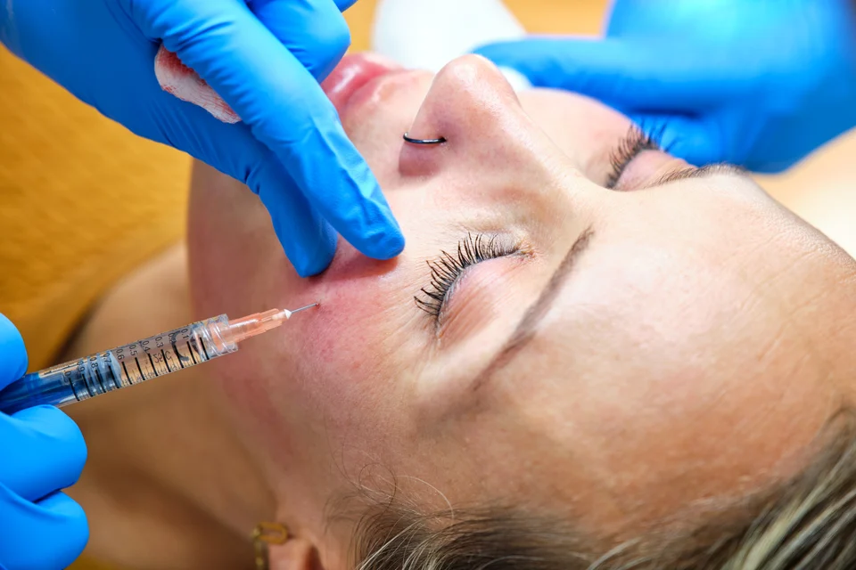 Ästhetische Behandlung – Faltenunterspritzung mit Hyaluron: Frischekur für müde Gesichter