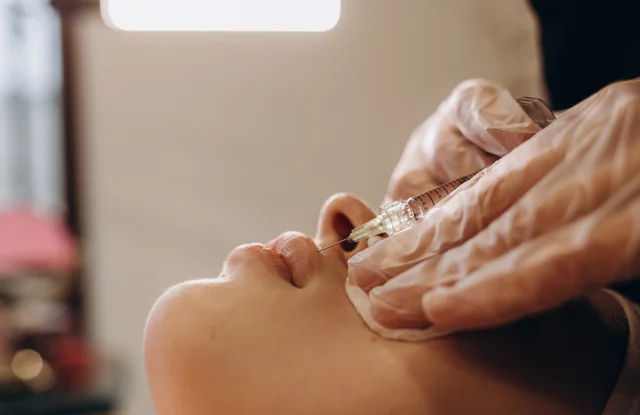 Lippenbehandlung – Lippenunterspritzung Gernsheim – natürlich volle Lippen mit Hyaluron