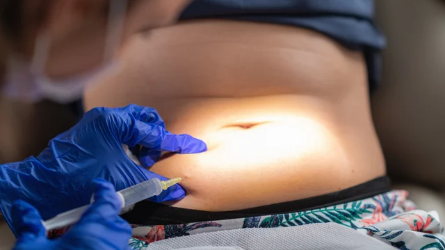 Ästhetische Behandlung – Alidya: Wie viele Sitzungen sind nötig?