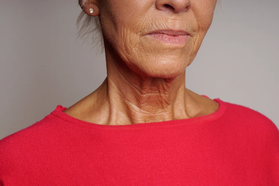 Ästhetische Behandlung – Hyaluron-Unterspritzung: Wer darf es wirklich?