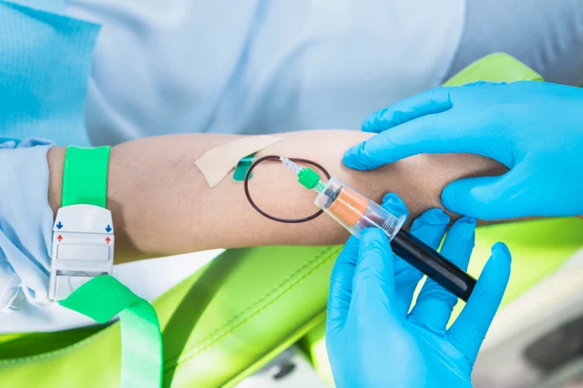 Labordiagnostik – Cholesterin senken: Ernährung, Bewegung und Laborwerte