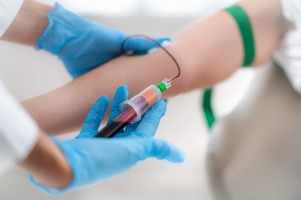 Labordiagnostik – Eisenmangel Mannheim: Labor und Beratung in Lampertheim