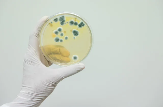 Labordiagnostik – Vitamin D und Eisenmangel: Zusammenhänge im Blutbild