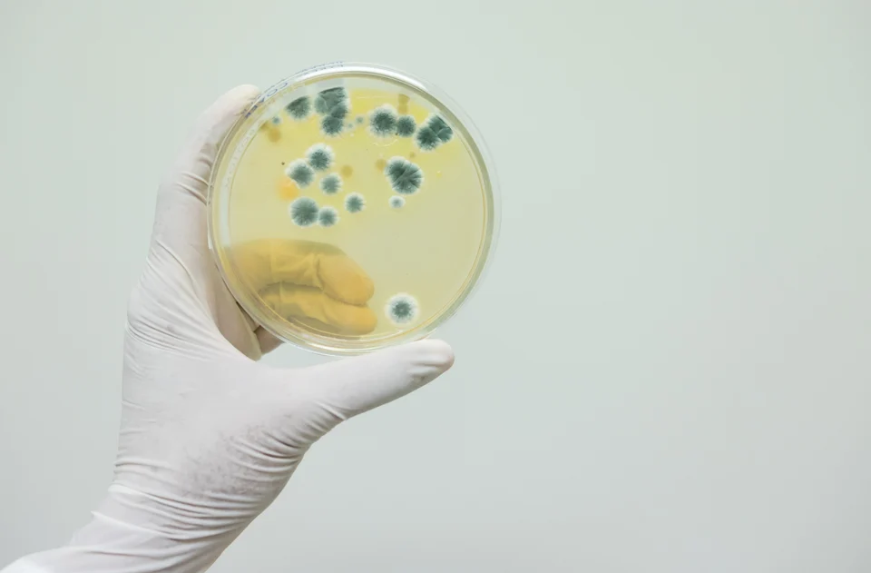 Labordiagnostik – Vitamin D und Eisenmangel: Zusammenhänge im Blutbild