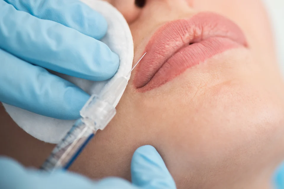 Lippenbehandlung – Lippenunterspritzung für Patientinnen aus Mannheim – bewusst außerhalb der Innenstadt