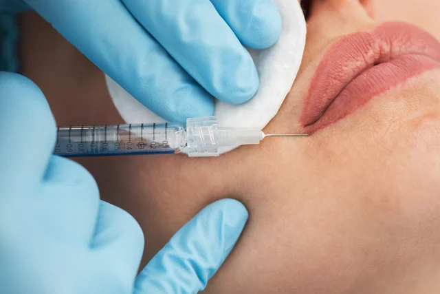 Lippenbehandlung – Lippenunterspritzung oder Lip Flip – was passt besser?