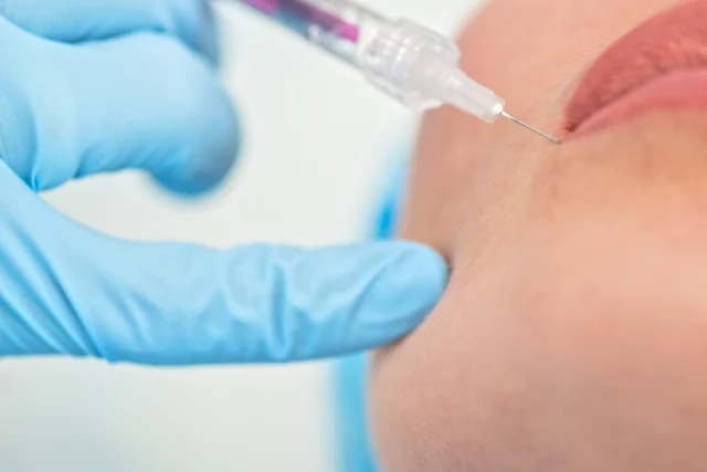 Lippenbehandlung – Lippenunterspritzung für Patientinnen aus Worms – natürlich, diskret & gut erreichbar