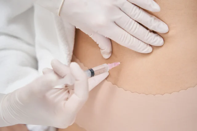 Ästhetische Behandlung – Alidya vs. Fett-weg-Spritze: Cellulite oder Fettdepot?