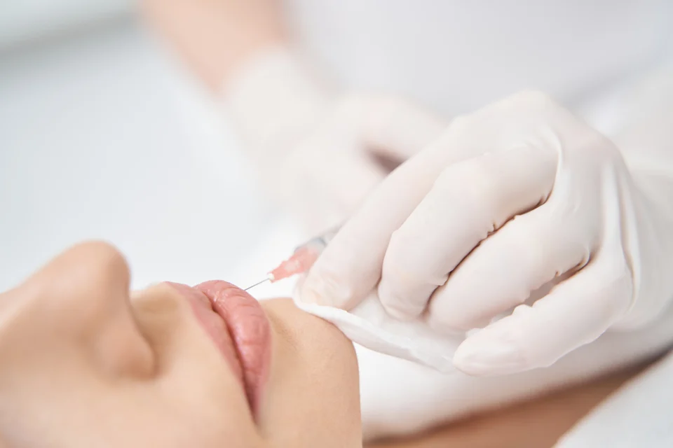 Lippenbehandlung – Lippenunterspritzung Tag 1 bis 14: Schwellung, Asymmetrie und Endergebnis