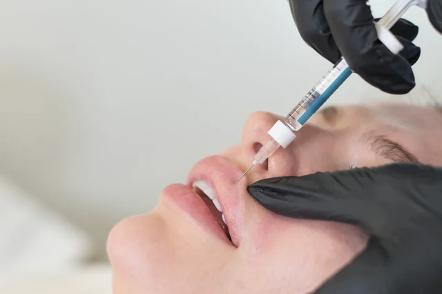 Lippenbehandlung – Wie lange hält Hyaluron in den Lippen wirklich?