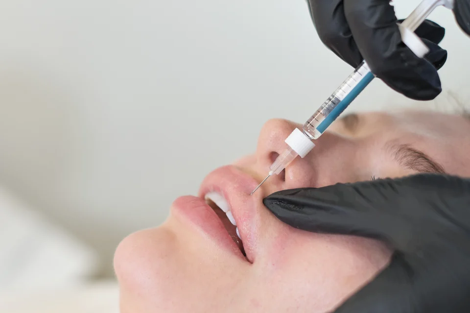 Lippenbehandlung – Wie lange hält Hyaluron in den Lippen wirklich?